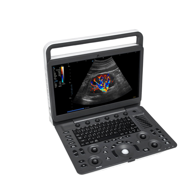 161-HY-M60 2024 Portable 3D Doppler Ultrasound Scanner Machine New Version Laptop Compatibility Color Me.jpg